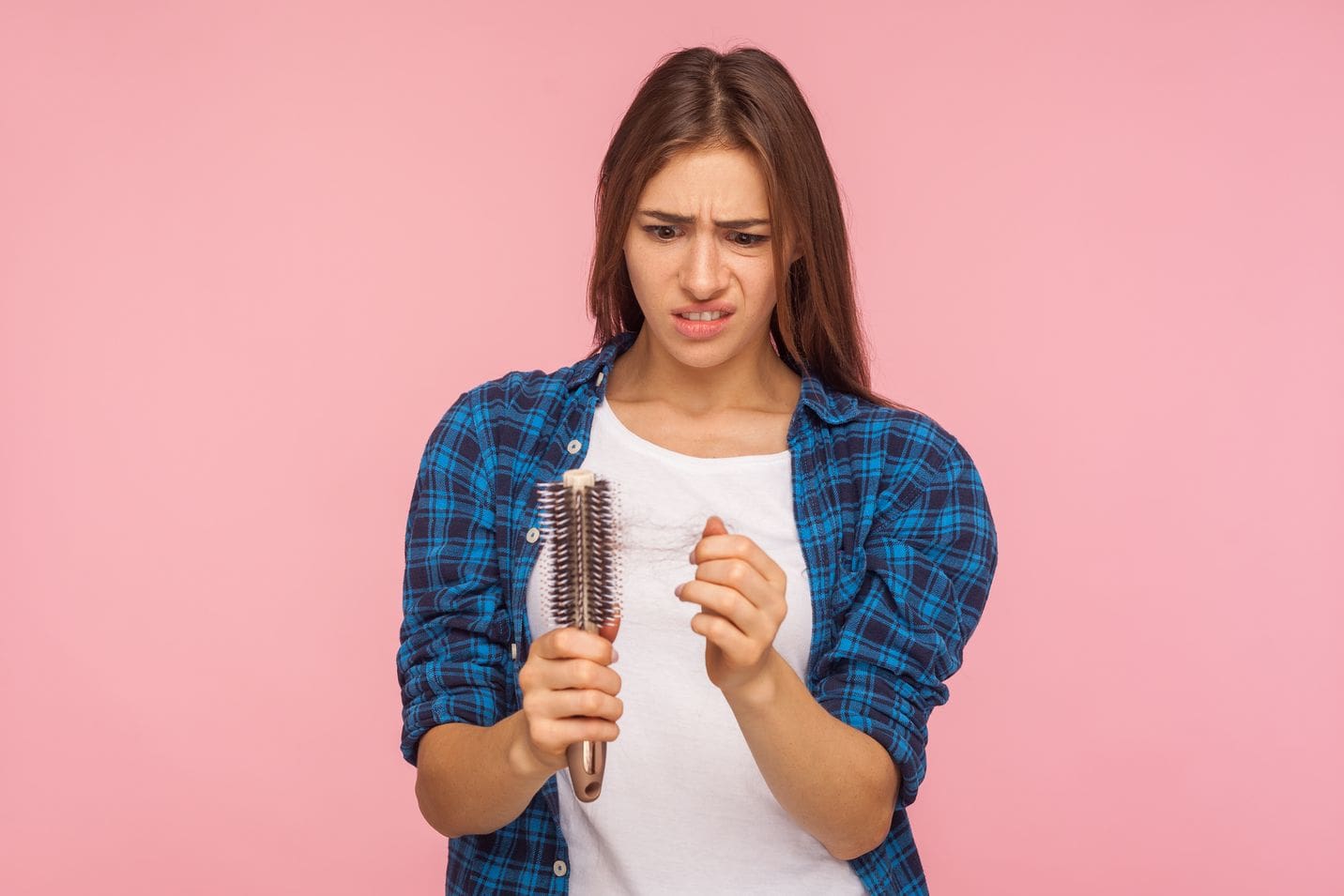 Hair loss overview