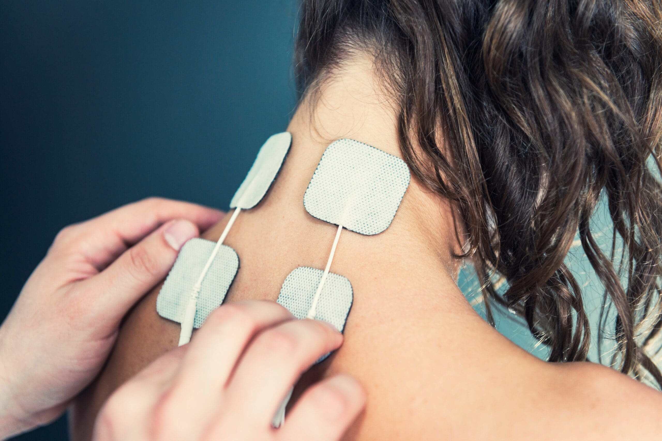 TENS – transcutaneous electrical nerve stimulation TENS – transcutaneous electrical nerve stimulation