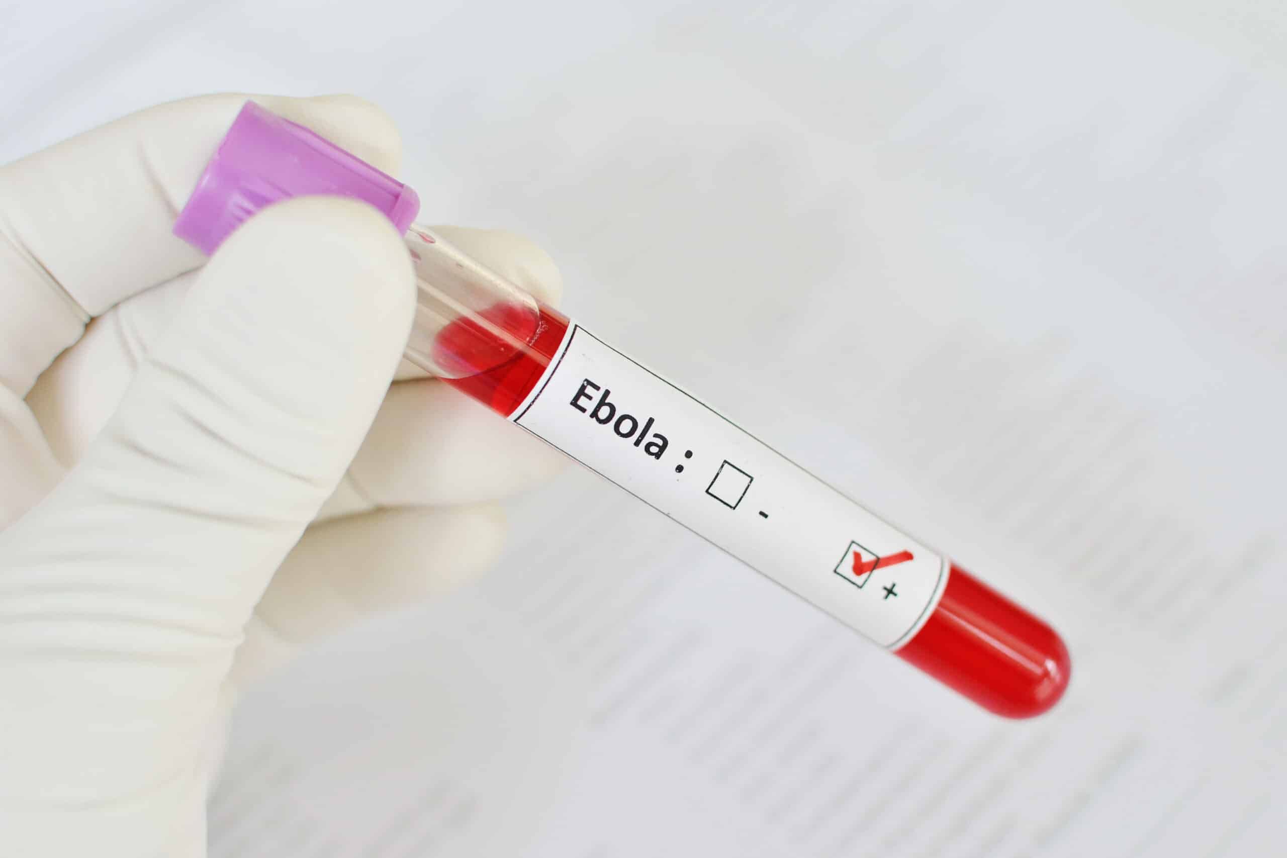 Ebola virus disease