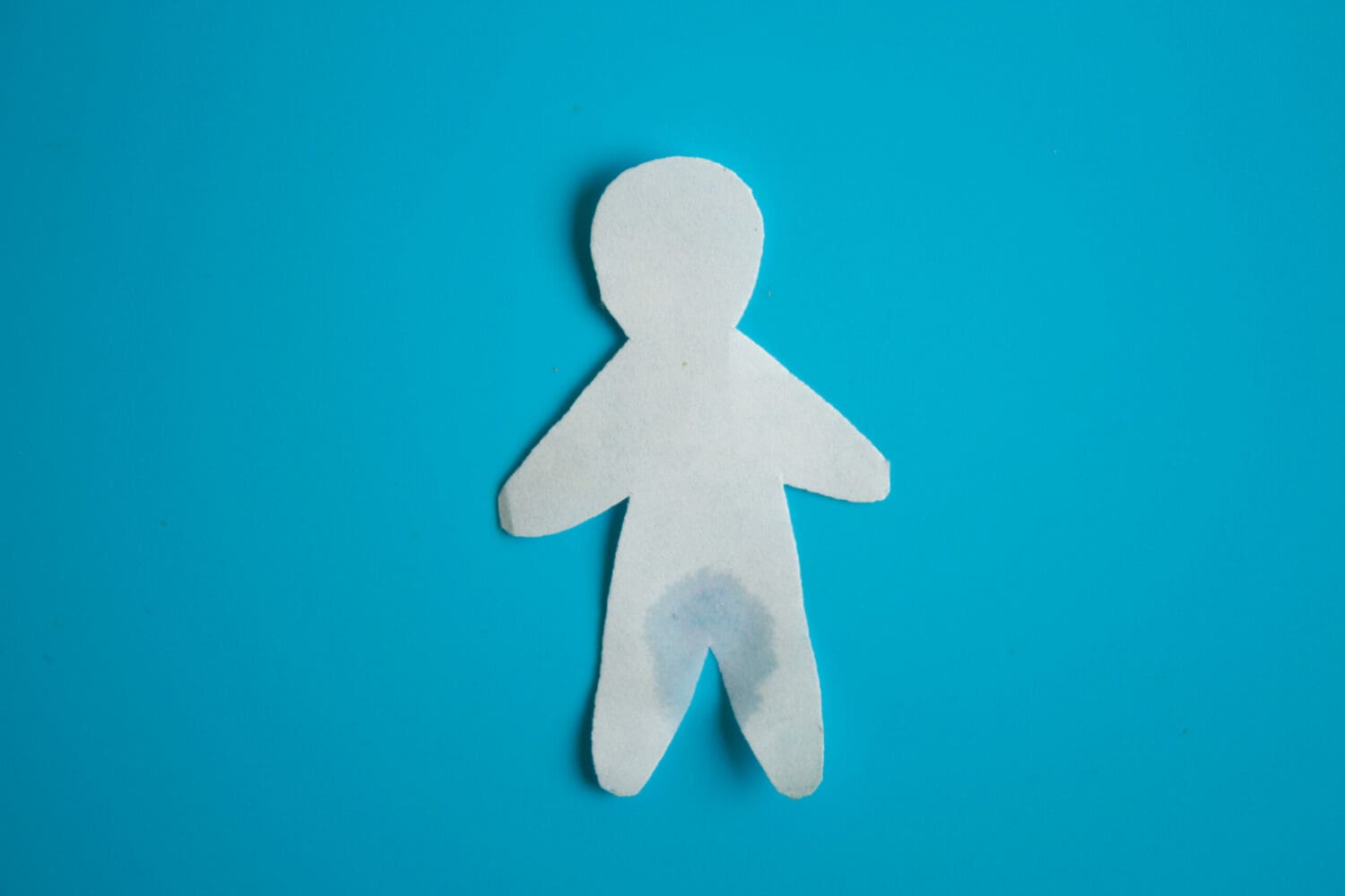 Urinary incontinence bladder