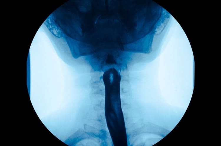 barium swallow tests