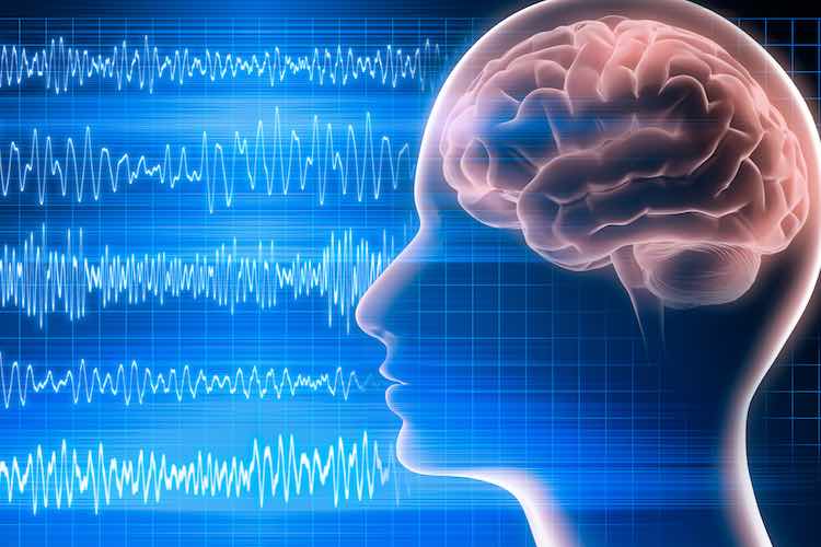 EEG 3