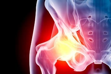 hip_joint