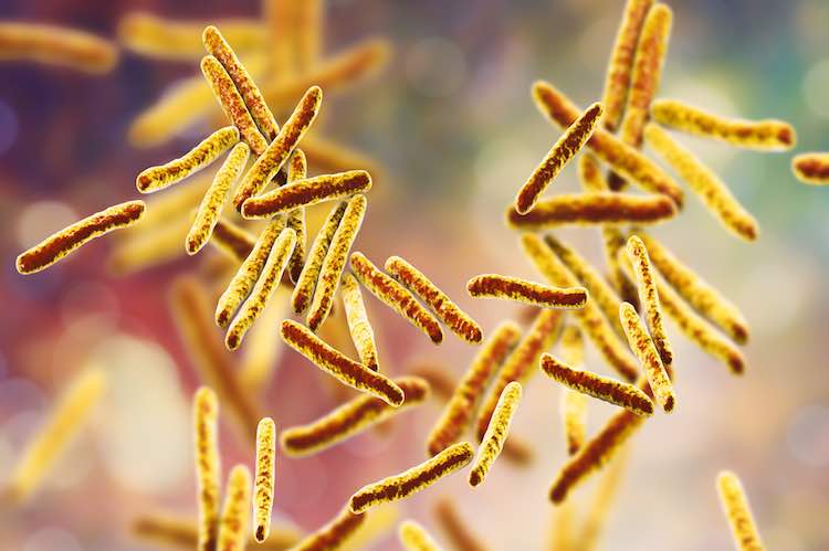 Tuberculosis