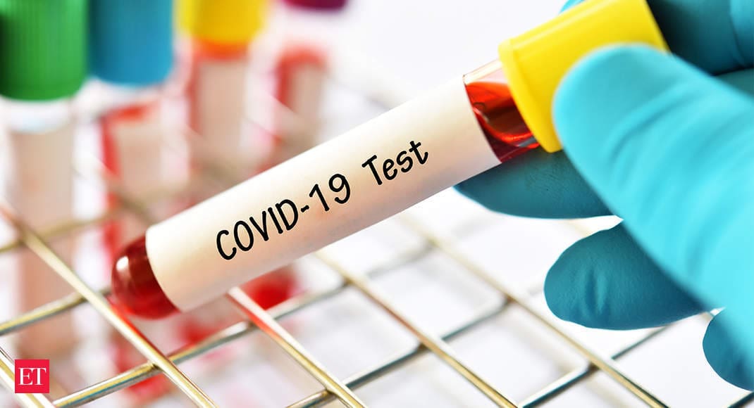 Australian scientists map the immune response to COVID-19