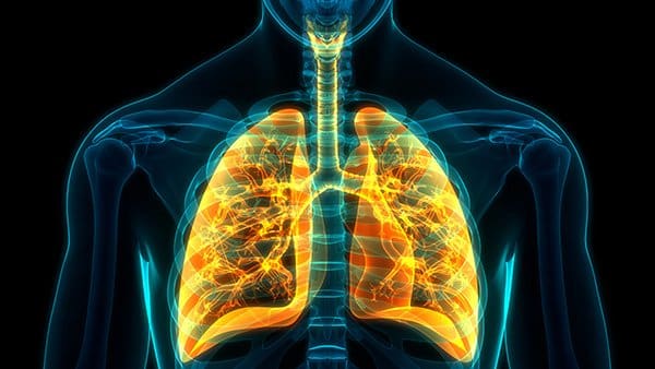 Inside the lungs of a patient with COVID-19