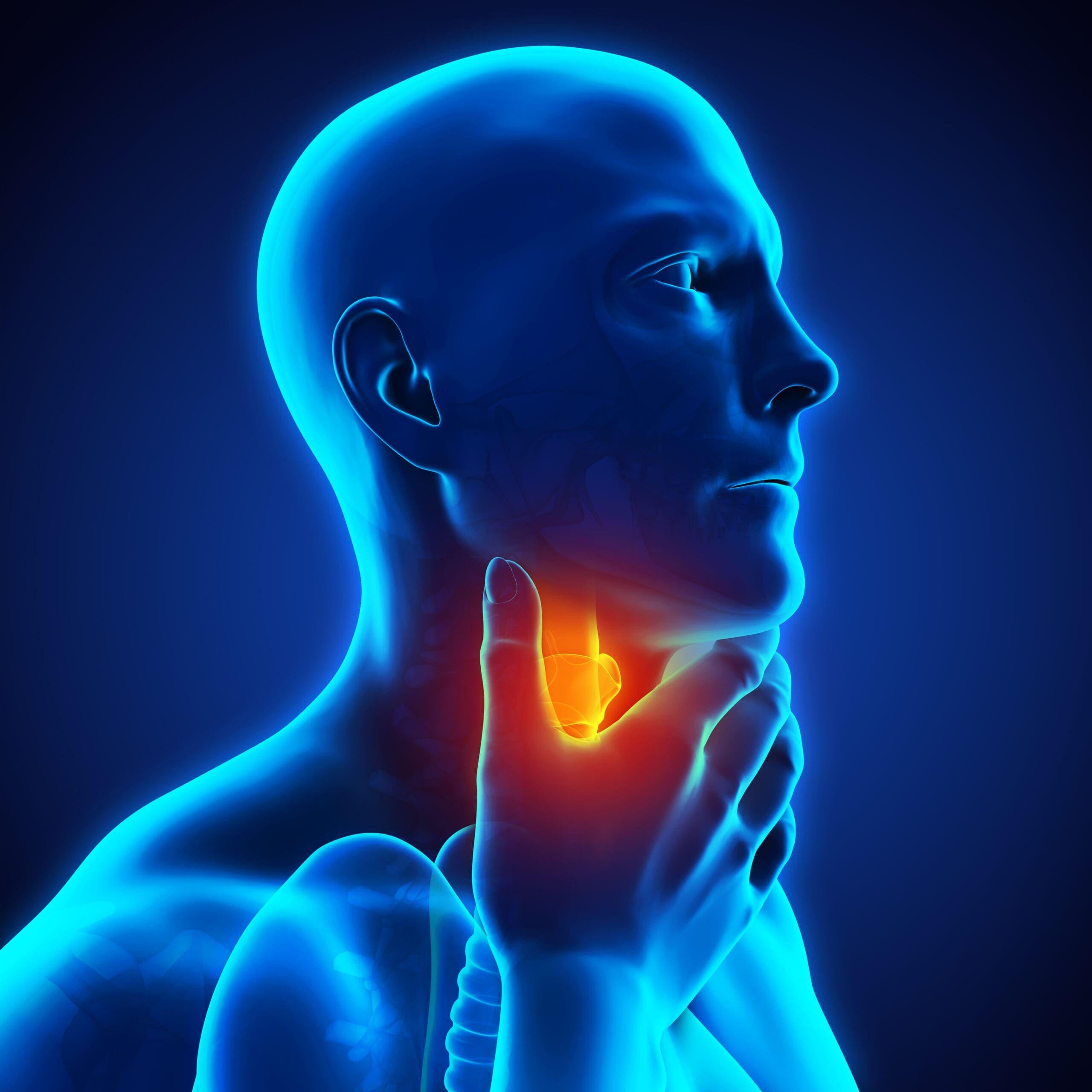 What is leukoplakia?