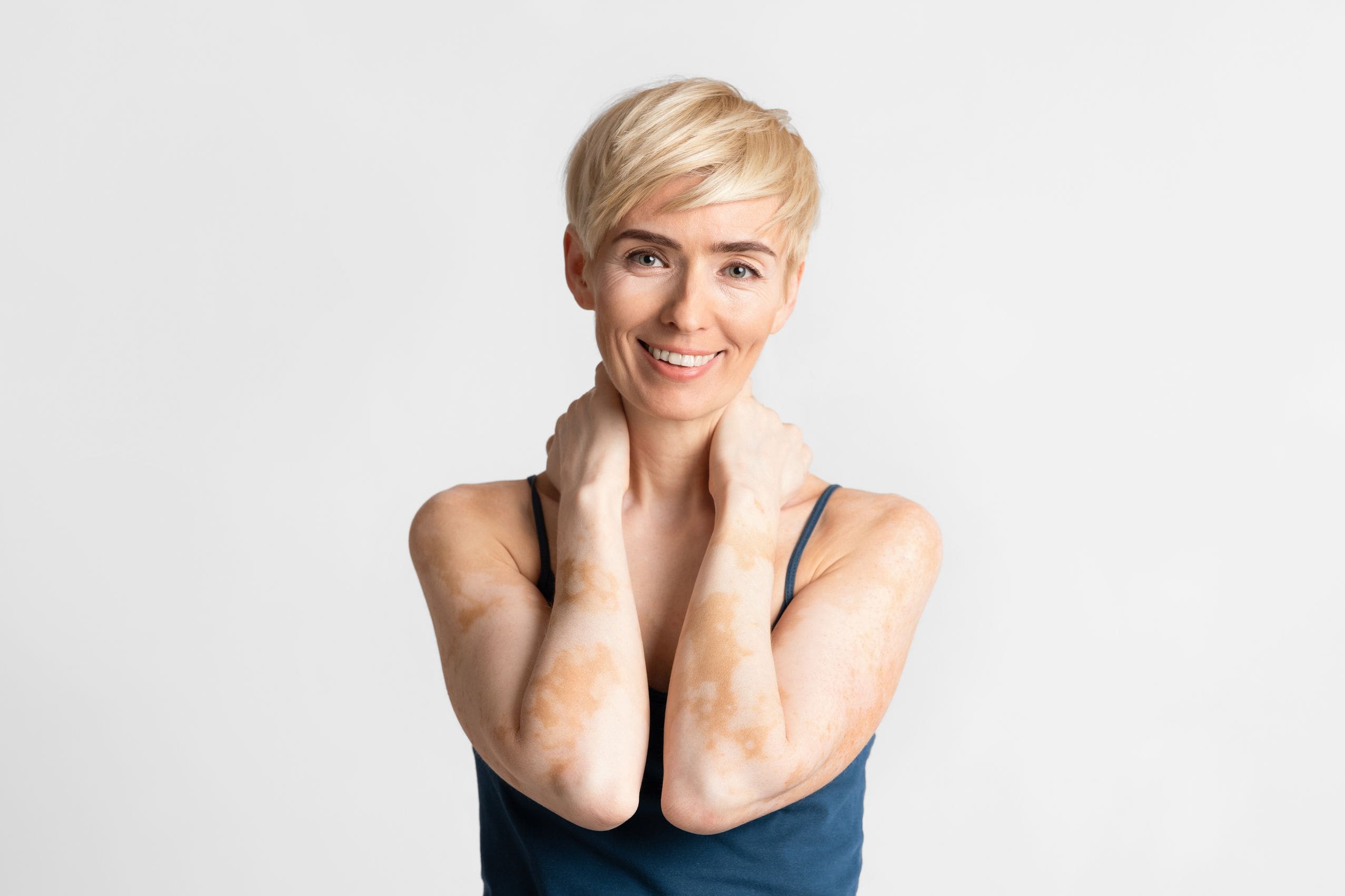 What are the most common autoimmune diseases?