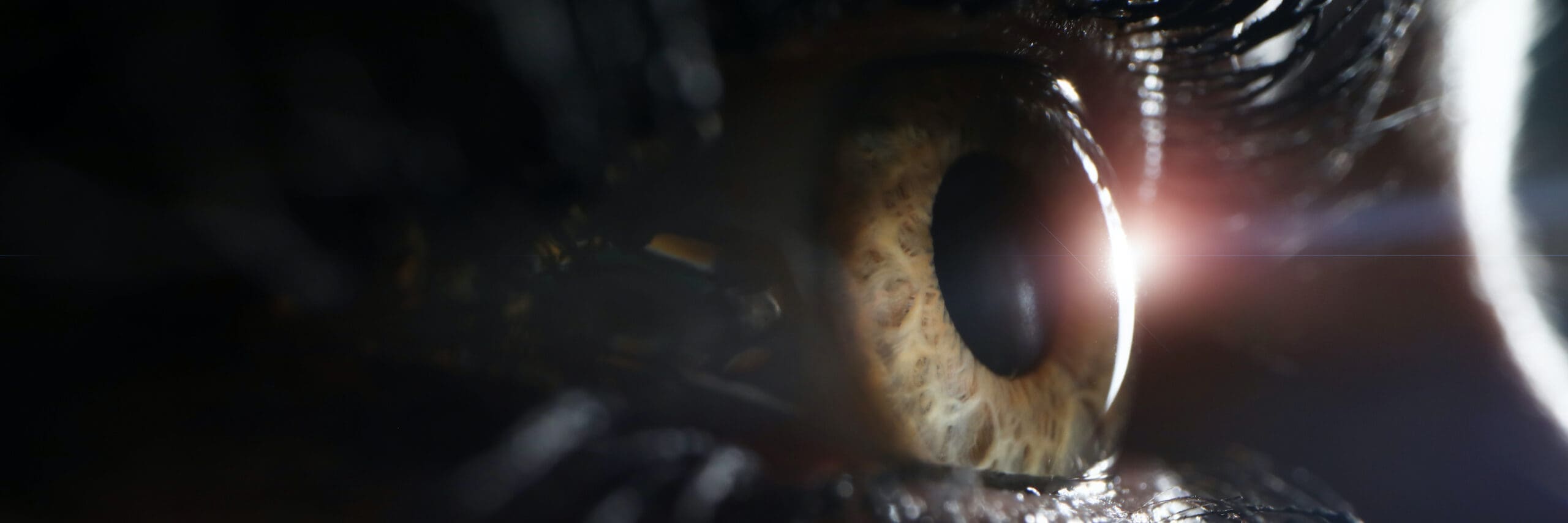Diabetes and Vision Loss – Dr. Norman Swan