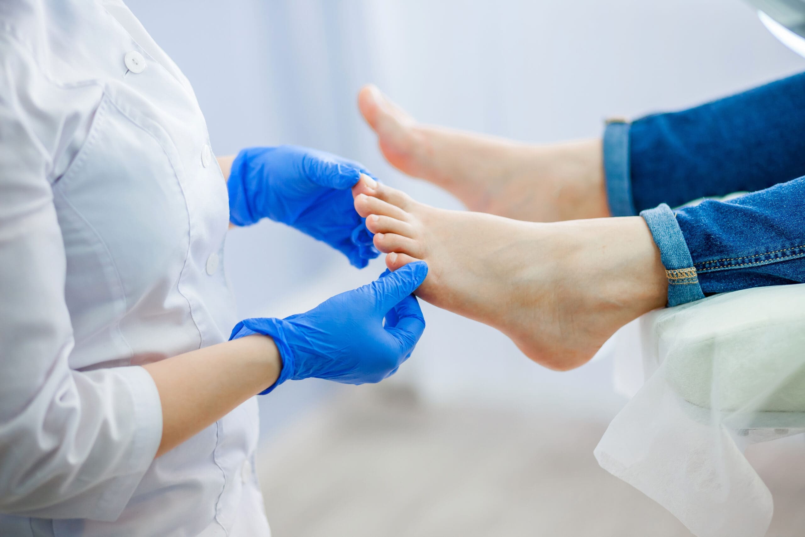 Athlete’s Foot