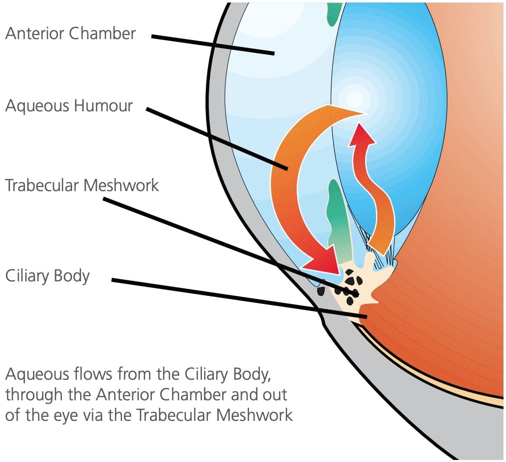 what is glaucoma