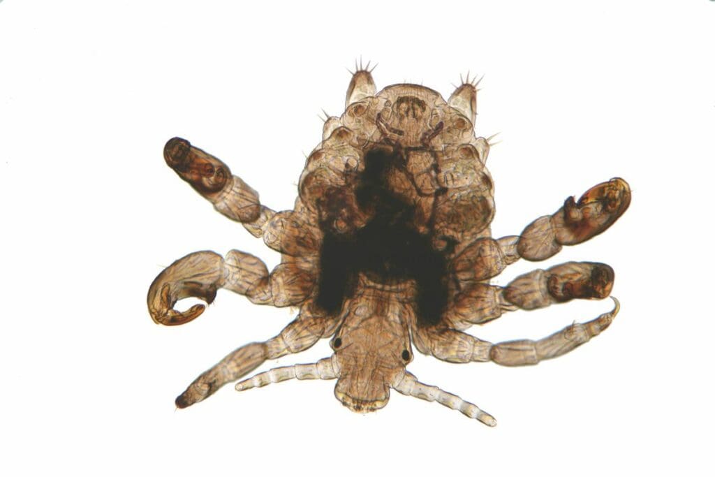 pubic louse