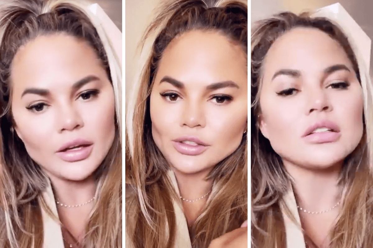Chrissy Teigen discusses her Buccal Fat Removal procedure on social media