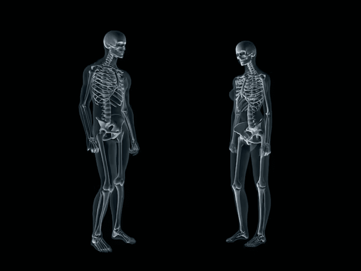 bone scan of male and female body who may have osteoporosis