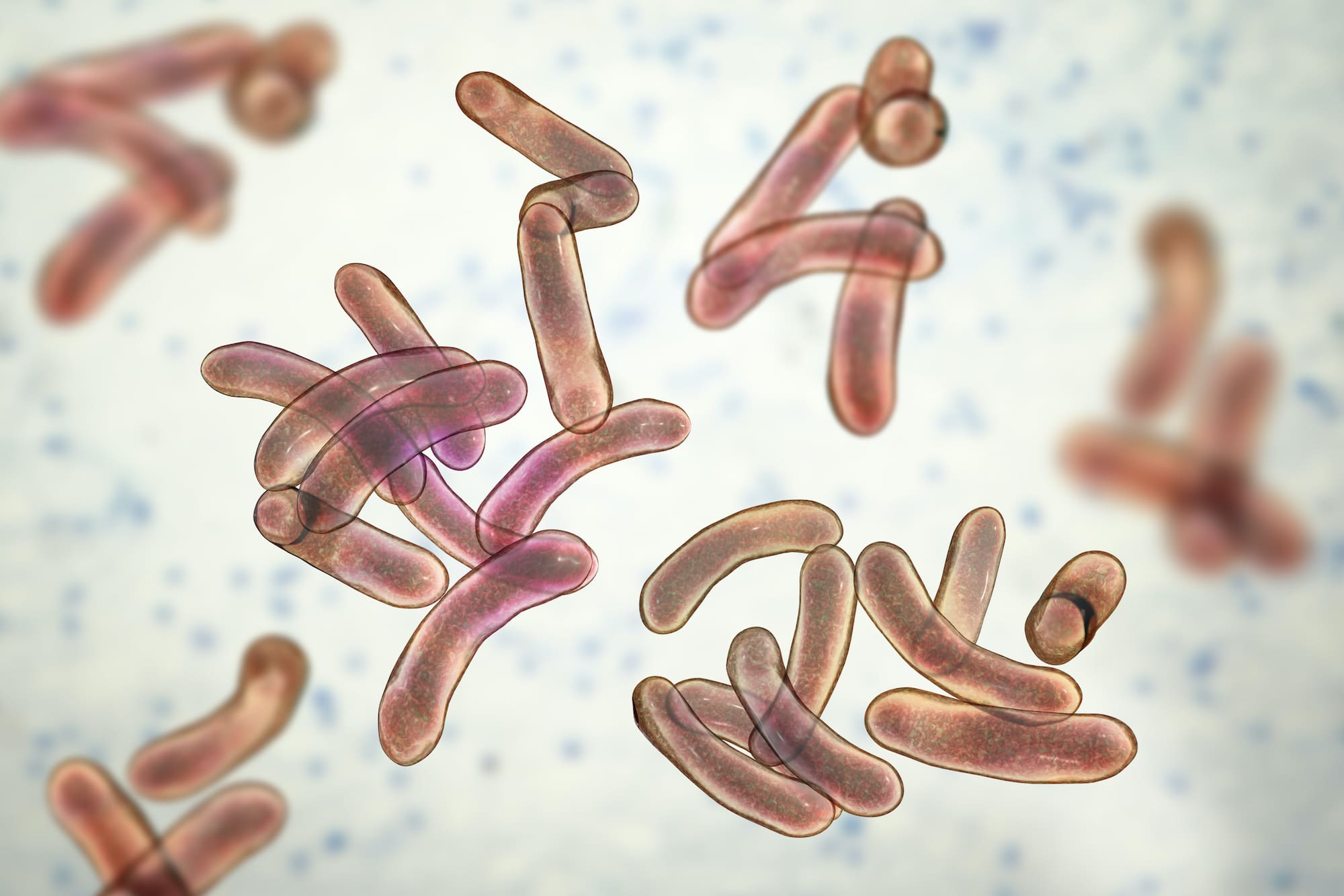 Cholera: Signs, symptoms and treatment