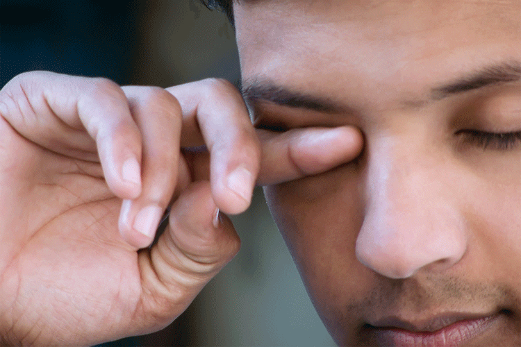 Eye allergy – allergic conjunctivitis