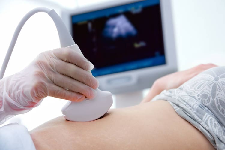 amniocentesis_750