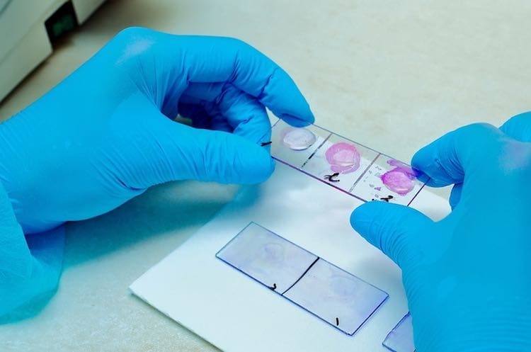 Microscope. Microbiological laboratory. Mold and fungal cultures. Bacterial research. Microbiology