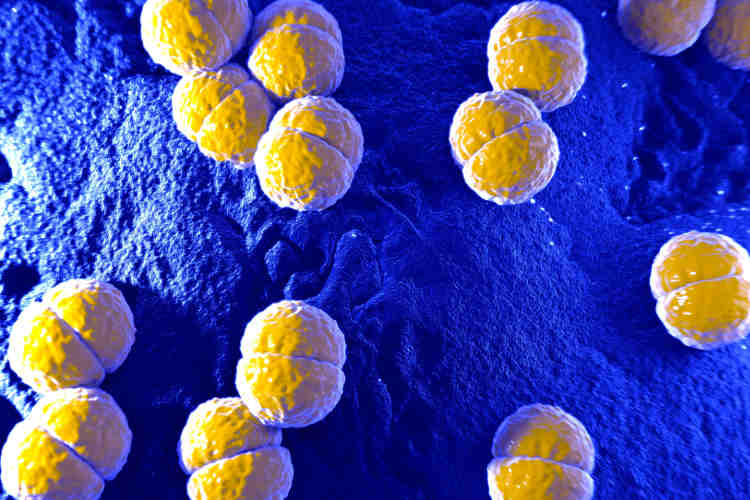 Meningococcal disease