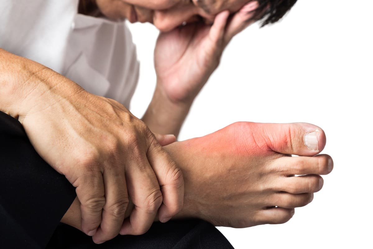 Gout pain