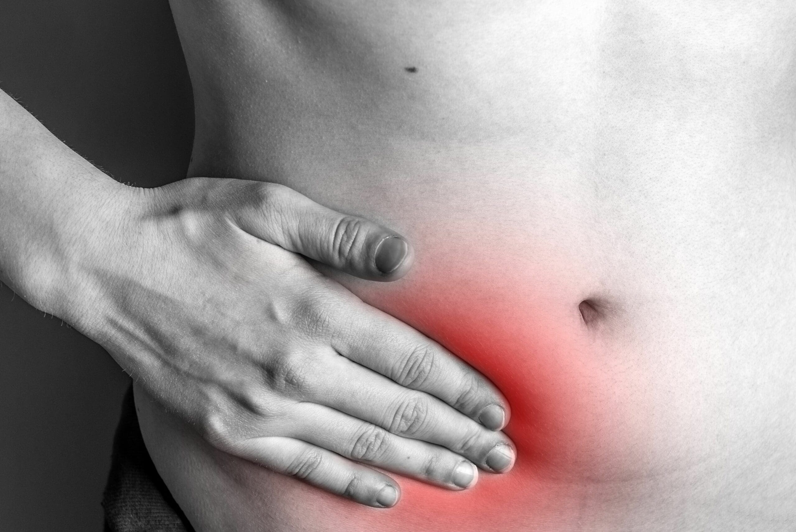 Hiatus hernia