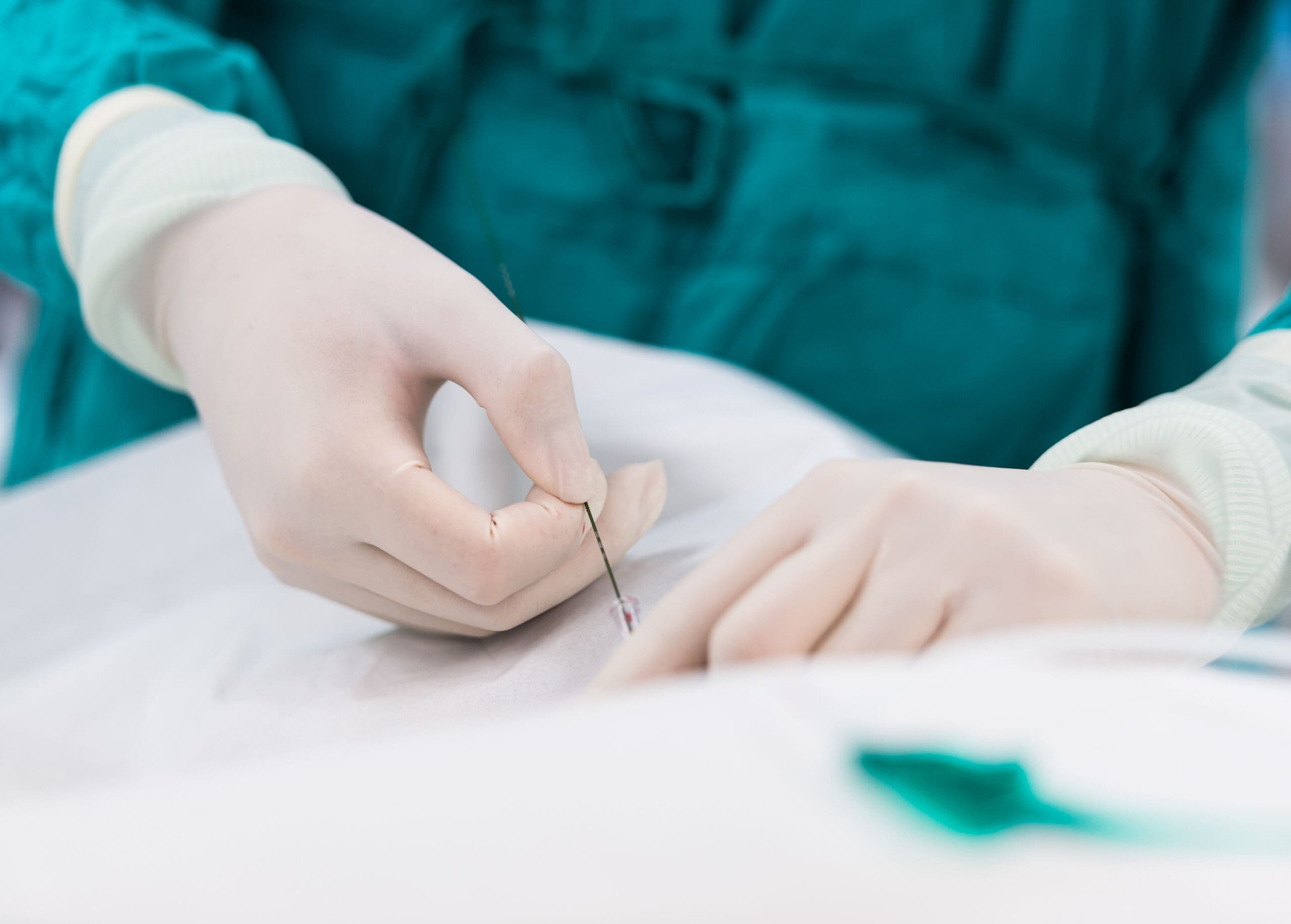 I have angina – should I get a stent?