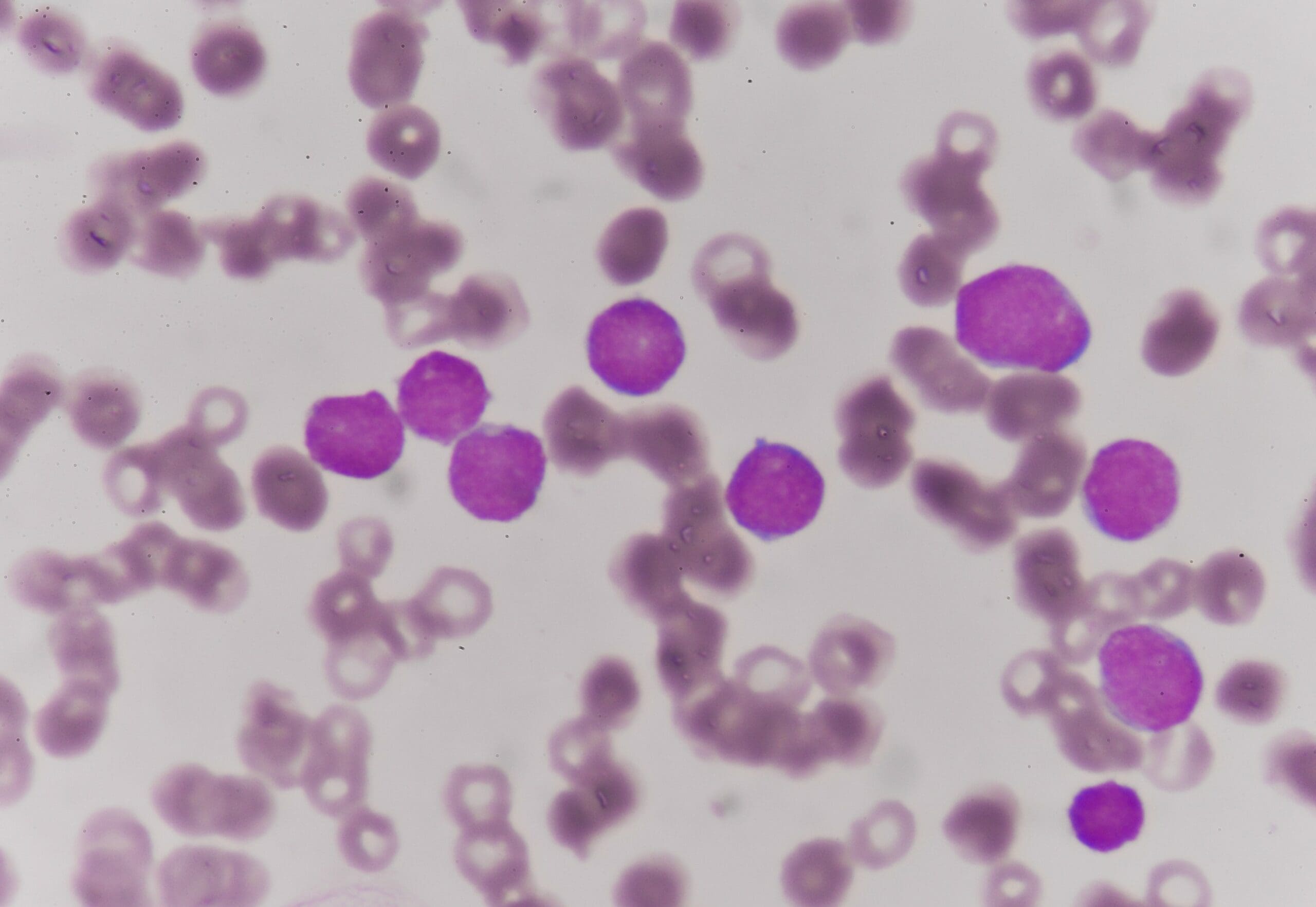 What are some examples of rare cancers?