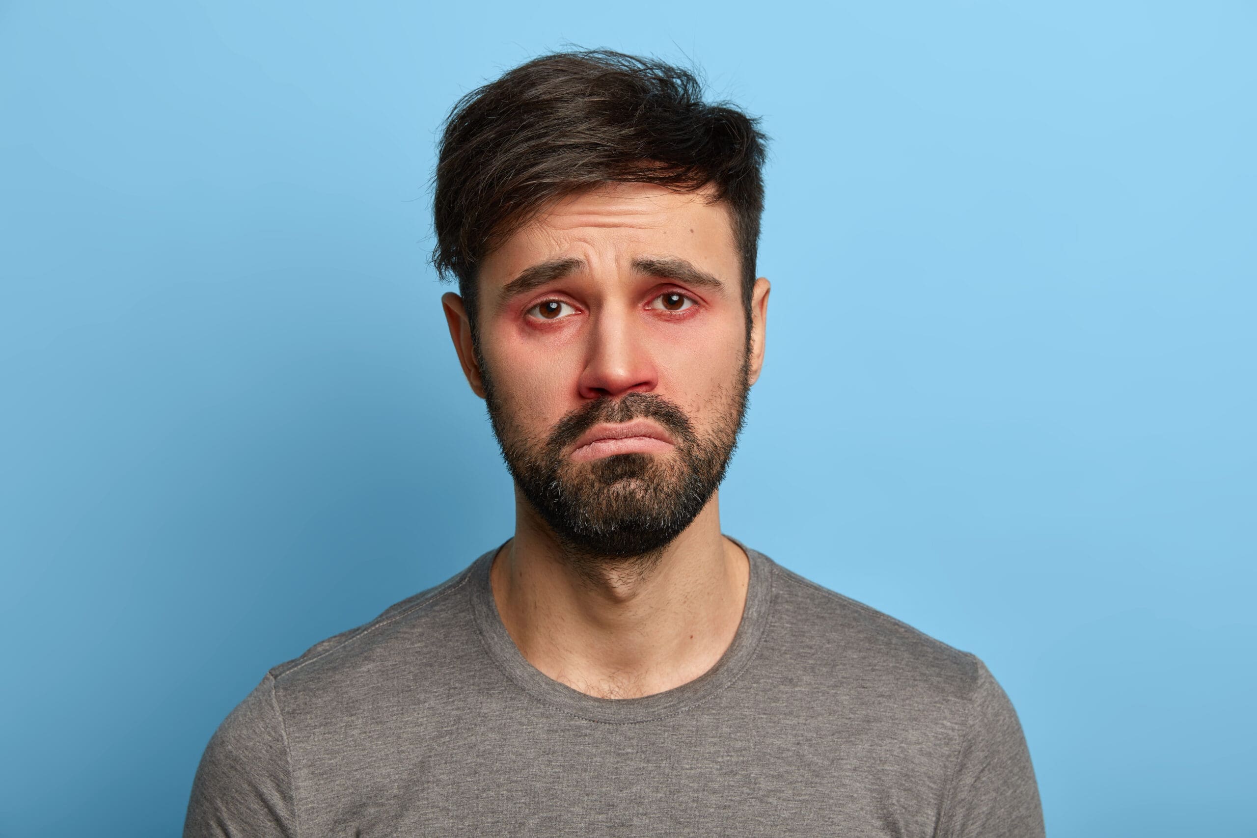 Conjunctivitis