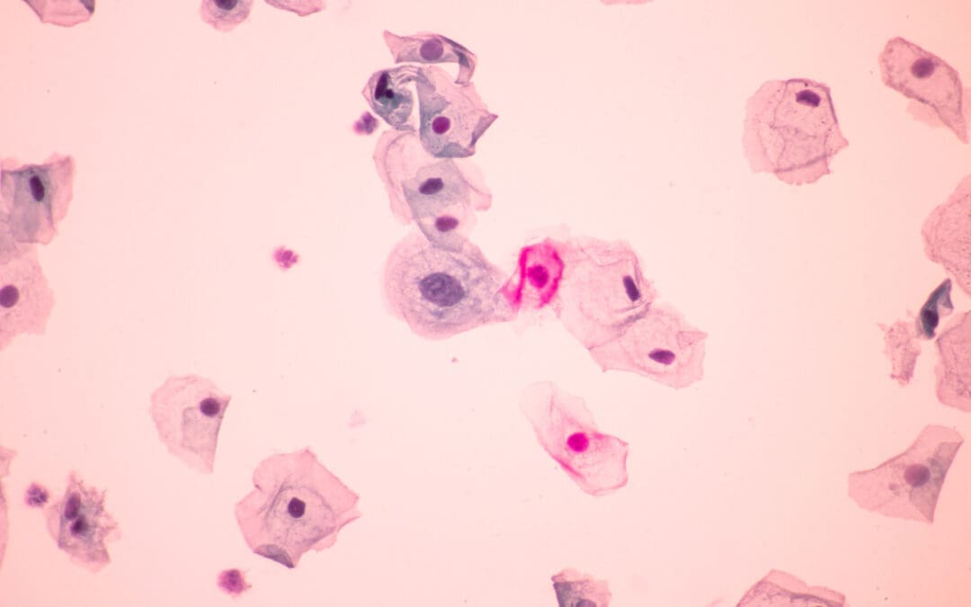 You can now DIY your cervical screening test